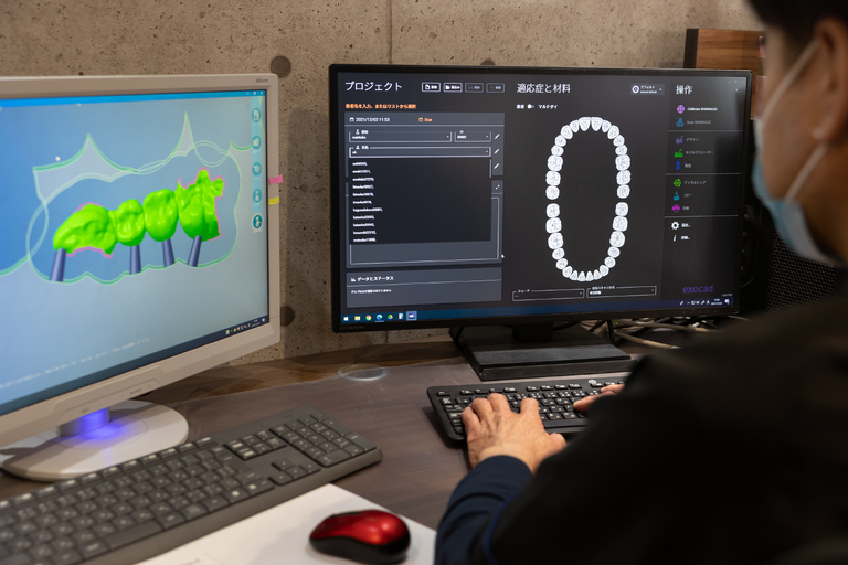 CAD/CAM